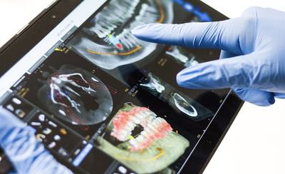 Odontólogo con guantes revisa un escáner dental en 3D sobre una tableta